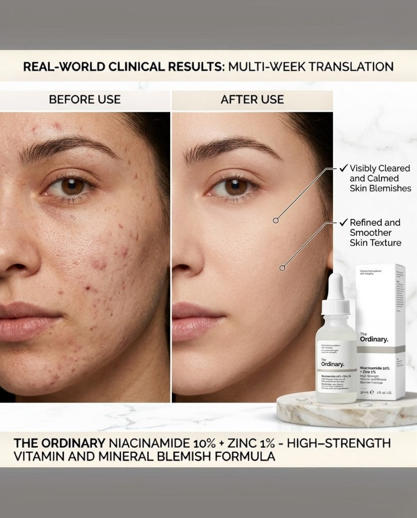 The Ordinary Niacinamide 10% + Zinc 1% - 30ml